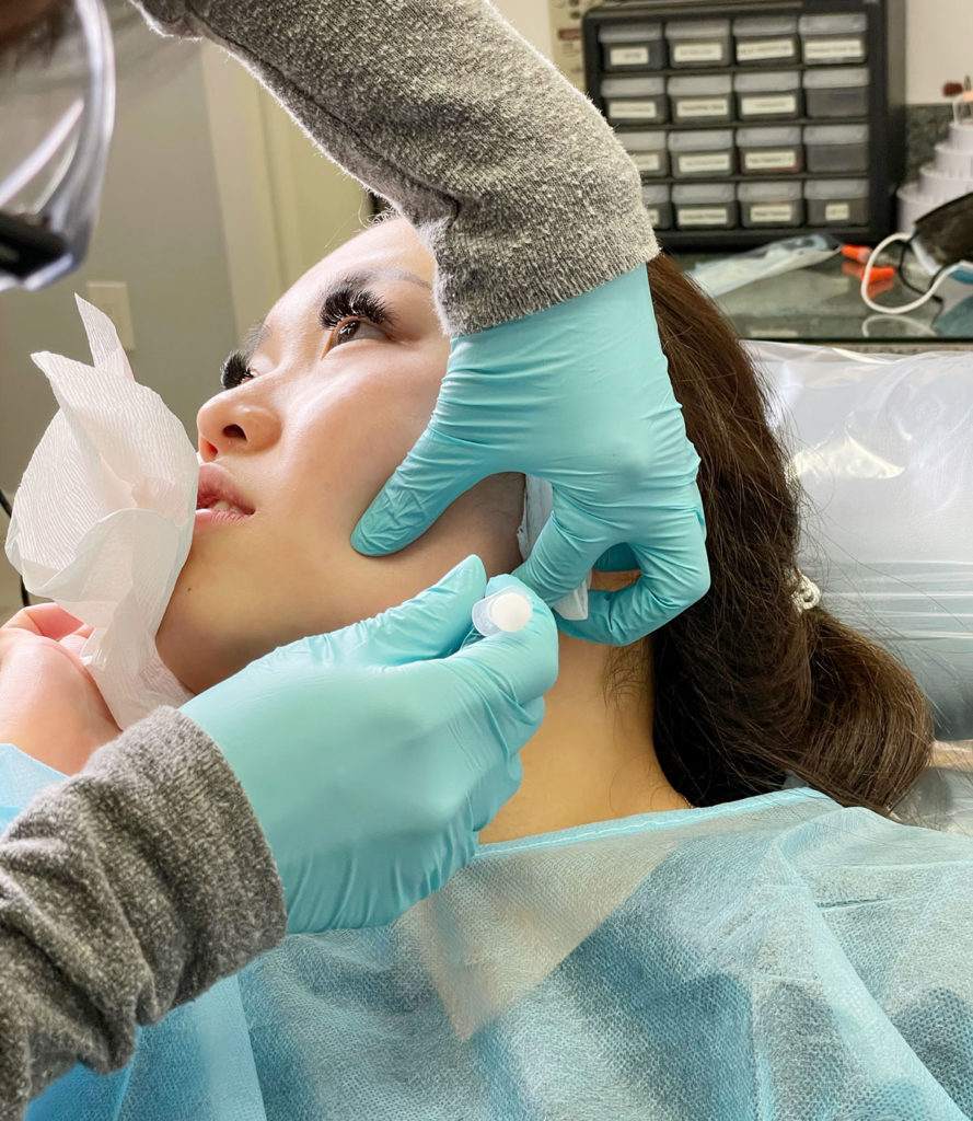 Patient receives Botox injection below her jaw.